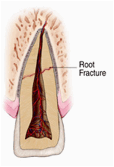 traumaticinjuries05