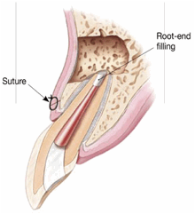 surgery3